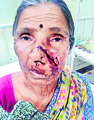 పిచ్చి కుక్క స్వైరవిహారం 1