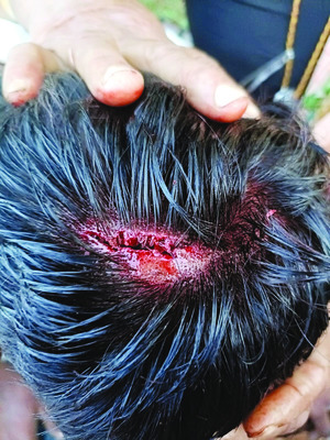 టీడీపీ నాయకుల బరి తెగింపు 1
