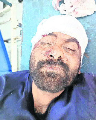 రైలు నుంచి జారిపడిన వ్యక్తి మృతి
2