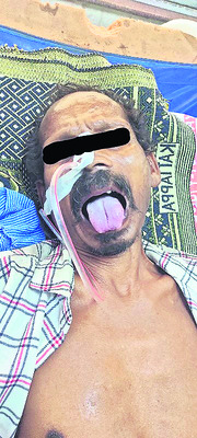 రిమ్స్లో అరుదైన చికిత్స 1