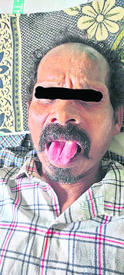 రిమ్స్‌లో అరుదైన చికిత్స 2