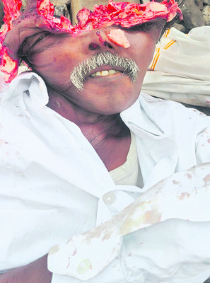 గోడపై నుంచి పడి మహిళకు తీవ్ర గాయాలు1
