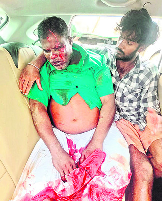 నిర్మాణంలో వున్న బ్రిడ్జిని ఢీకొన్న కారు2