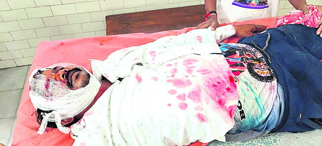నగరంలో కోతుల బీభత్సం
1