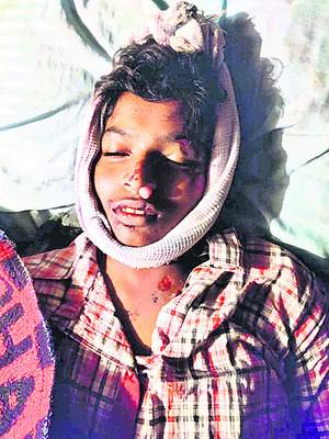 పరికరాలు లేవు..  వైద్యం అందించలేము2