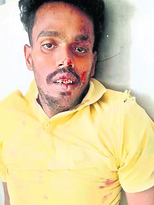బస్సు, టెంపో ఢీ
1
