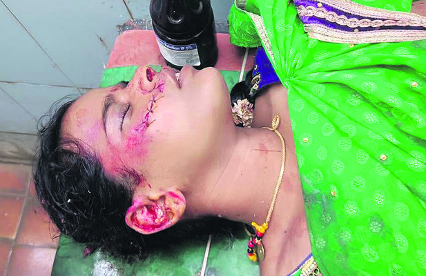కుక్క అడ్డురావడంతో అదుపుతప్పి ఆటోబోల్తా 1