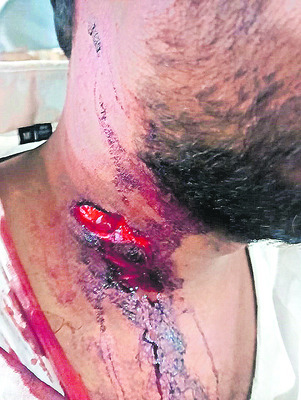 రైతులను ప్రభుత్వం ఆదుకోవాలి
1