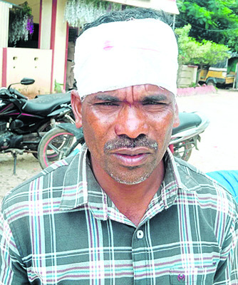 బైక్లు ఢీకొని ముగ్గురికి తీవ్ర గాయాలు 1