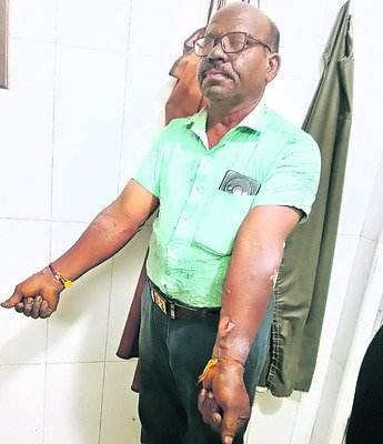 గ్యాస్ సిలిండర్ పేలి ముగ్గురికి గాయాలు2