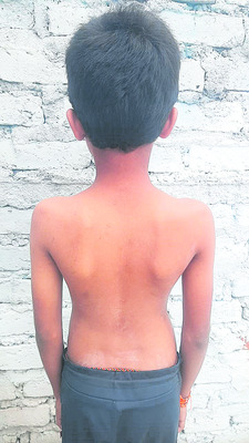గురుకులానికి గజ్జి1