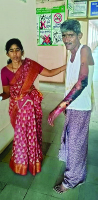 ఉపశమనం కాదు.. ప్రత్యక్ష నరకమే 1