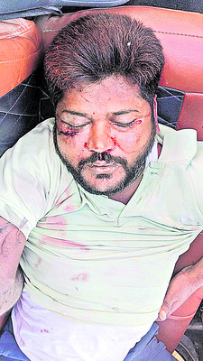 ద్విచక్ర వాహనాన్ని ఢీకొన్న కారు 1