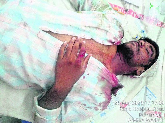 రోడ్డు ప్రమాదంలో ఒకరి మృతి1