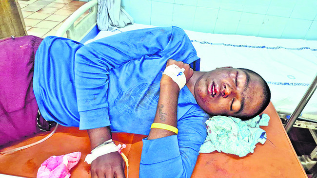 వేర్వేరు ప్రమాదాల్లో ఇద్దరికి తీవ్ర గాయాలు 1