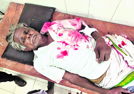 రోడ్డు ప్రమాదంలో  వ్యక్తికి గాయాలు   2