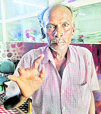 ఒంటి కన్నే దిక్కు... 
1