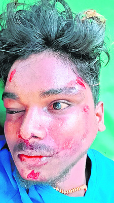 రోడ్డు ప్రమాదంలో ఇద్దరి మృతి3