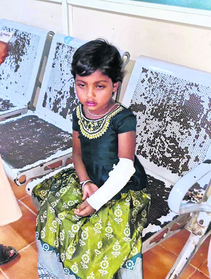వేర్వేరు ప్రమాదాల్లో ముగ్గురికి తీవ్రగాయాలు 1