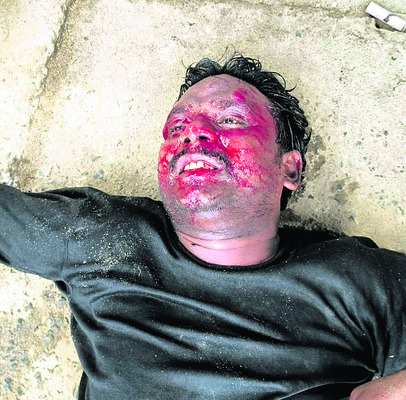 రోడ్డు ప్రమాదంలో ఒకరికి గాయాలు 2