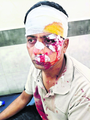 రోడ్డు ప్రమాదంలో  ముగ్గురికి గాయాలు 1