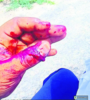 రోడ్డు ప్రమాదంలో  ముగ్గురికి గాయాలు 2