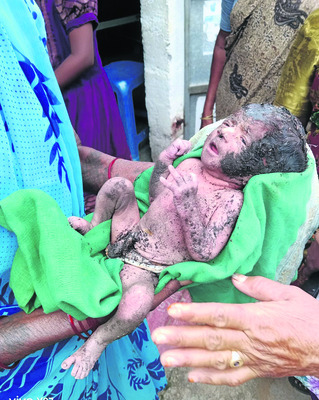 ఆపరేషన్ వికటించి బాలుడి మృతి2