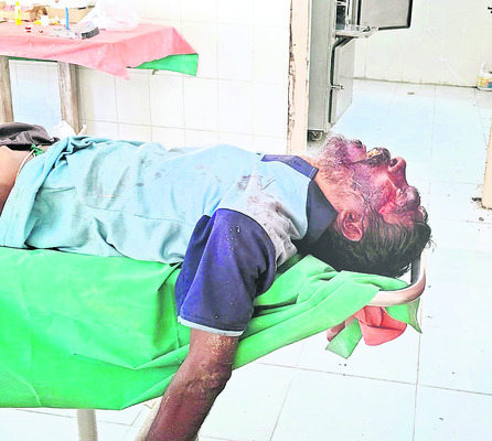 గొర్రెల మందపై దూసుకెళ్లిన లారీ 1