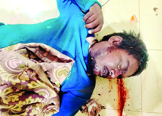 కౌన్సిలర్‌ చొరవతో         అంధుడికి వివాహం 3