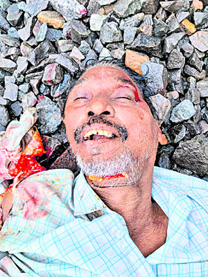 సింగ్నగర్కు పాకిన ‘డయేరియా’ ఎఫెక్ట్..! 2