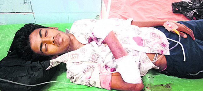 కారు ఢీకొని అన్నదమ్ములకు తీవ్రగాయాలు
1