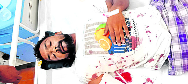 కారు ఢీకొని అన్నదమ్ములకు తీవ్రగాయాలు
2