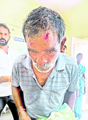 విద్యార్థిని చితకబాదిన కిరాణాషాపు యజమాని1