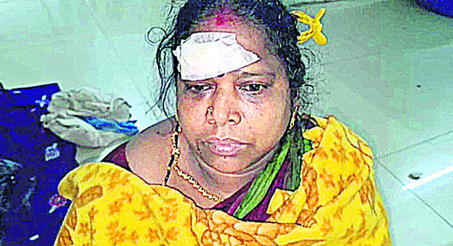 గుమ్మఘాటీలో బస్సు ప్రమాదం 3