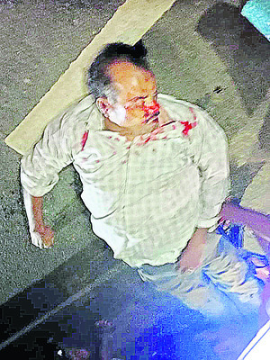గుర్తు తెలియని వాహనం ఢీకొని ఒకరి మృతి1