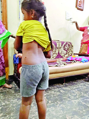 వీధికుక్క స్వైరవిహారం 1