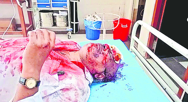 టైరు పేలి కారు బోల్తా 2