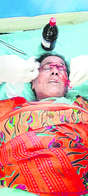 టైరు పేలి కారు బోల్తా 1