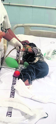 కుక్కల దాడిలో బాలుడికి గాయాలు 4