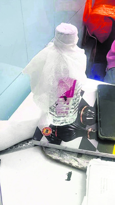 కుక్కల దాడిలో బాలుడికి గాయాలు 5