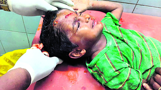 కుక్కల దాడిలో బాలుడికి గాయాలు 3