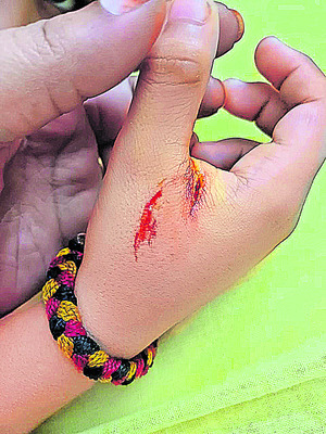 కుక్క దాడిలో బాలుడికి తీవ్రగాయాలు 2