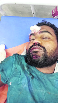 మెట్లపై నుంచి జారిపడి  వృద్ధురాలు మృతి1