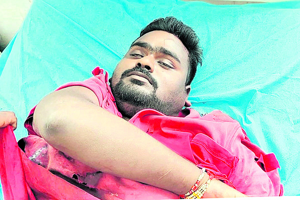 స్విమ్స్లో ఘనంగా వరల్డ్ హార్ట్ డే 1