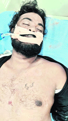 పొలంలో కారు బోల్తా 1