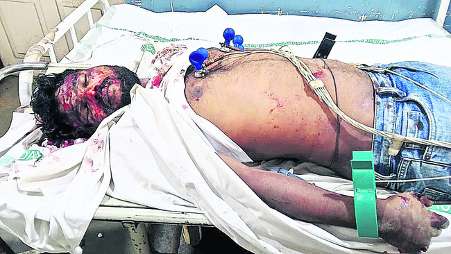 రోడ్డు ప్రమాదంలో యువకుడి మృతి1