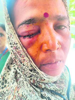 సోదరిపై మాజీ సర్పంచ్‌ దాడి 1