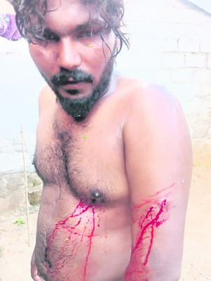 యువకుడిపై హత్యాయత్నం
1
