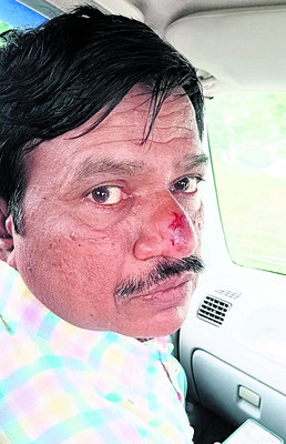 ఉపాధ్యాయుడిపై విద్యార్థి తండ్రి దాడి 1