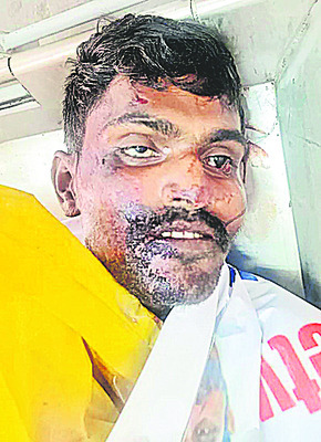 వేర్వేరు ప్రమాదాల్లో నలుగురు దుర్మరణం 1